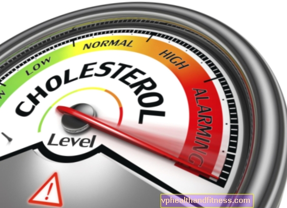 Colesterol total, LDL y HDL - normas