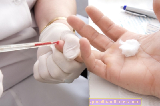 Diabetas - insulino ir kitų vaistų nuo diabeto kompensavimas