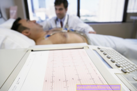 EKG - τα πλεονεκτήματα και τα μειονεκτήματα αυτού του καρδιακού τεστ