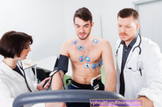 ECG de esfuerzo (prueba de esfuerzo): prueba del funcionamiento del corazón