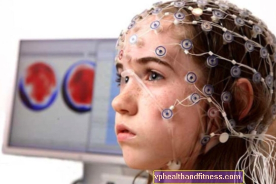 Електроенцефалографията (ЕЕГ) е изследване, което диагностицира заболяване в мозъка. Какво представлява ЕЕГ?