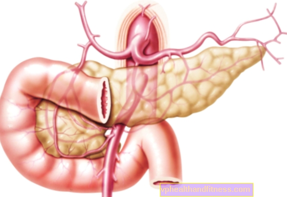 Colangiopancreatografía retrógrada endoscópica (CPRE): examen del tracto biliar y el páncreas