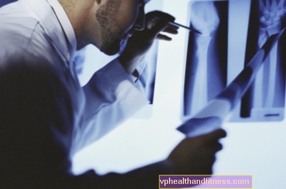 Fistulografía: radiografía de una fístula