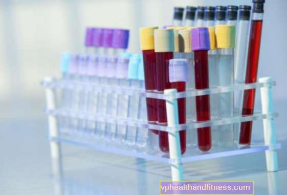 Fosfatasa alcalina (ALP): normas en un análisis de sangre