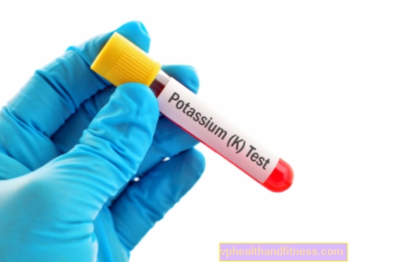 Hipopotasemia (deficiencia de potasio): causas, síntomas y tratamiento