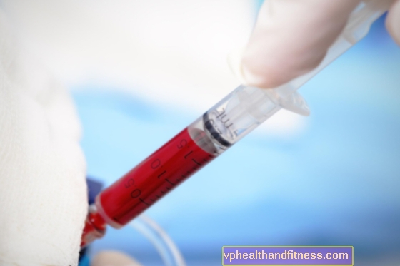 Ácido úrico: normas en un análisis de sangre.