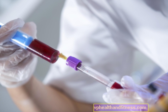 Lymfocytter: normer i en blodprøve. Hvilken rolle spiller lymfocytter?