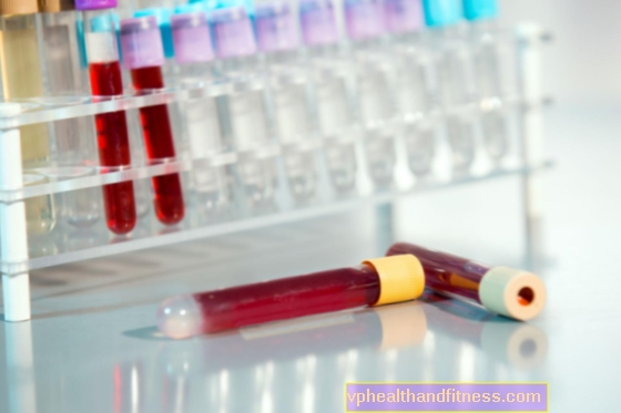 Lipidogram - ett test som bestämmer nivån av lipider