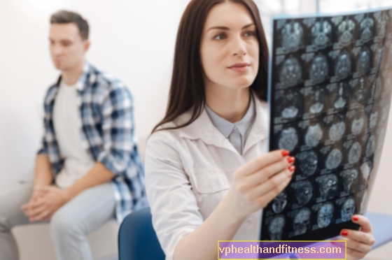 Neurología: ¿qué hace un neurólogo y qué enfermedades trata?