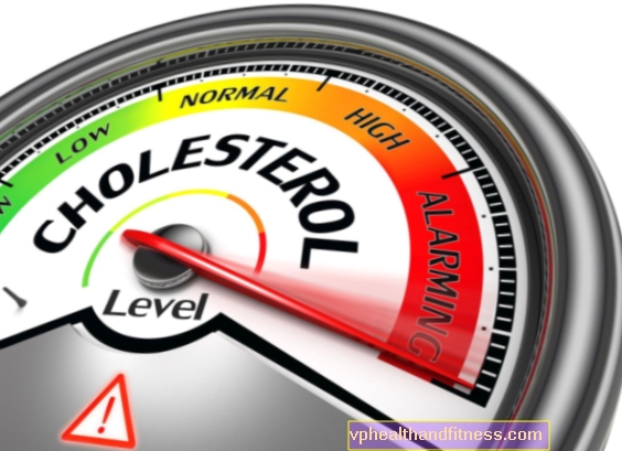 Yüksek kolesterolün belirtileri. Kolesterolümün çok yüksek olup olmadığını nasıl anlarım?