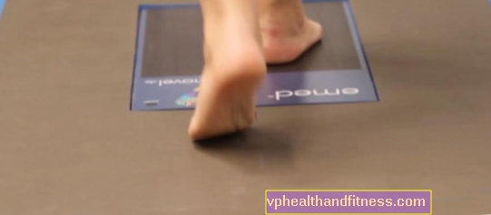 Pedobarografie - een moderne studie van voetziekten