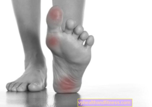Bolovi u stopalima - uzroci. Koja se bolest očituje bolovima u stopalima?