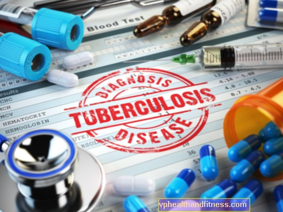 Tuberkuliini test - tuberkuloosi diagnoosimise test