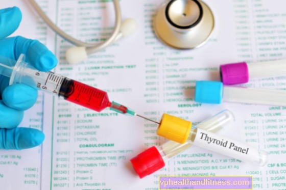 Anticuerpos anti-tiroideos anti-TG