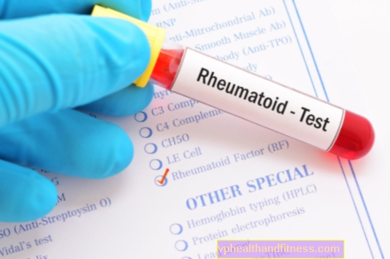 RF eller reumatoid faktor - definition, detektion och betydelse i patologi