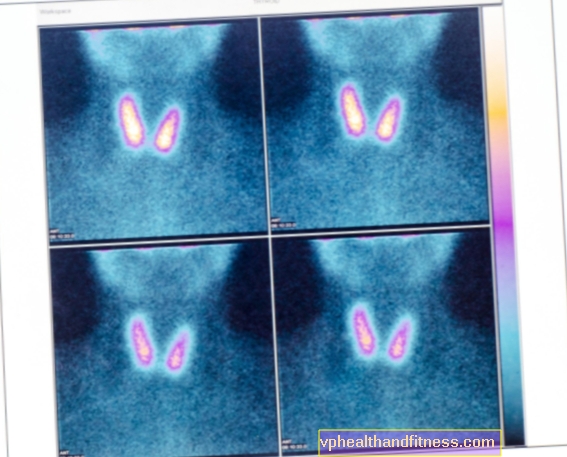 Gammagrafía: examen de isótopos de varios órganos