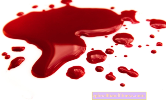 Тумачење снова - крв. Шта значи крвни сан?
