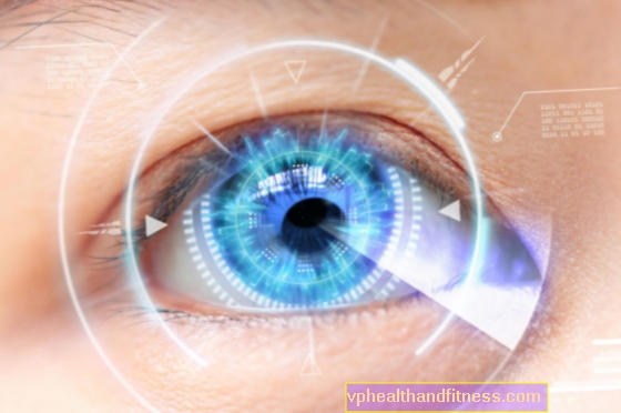 Skiaskopija - akių refrakcijos tyrimas