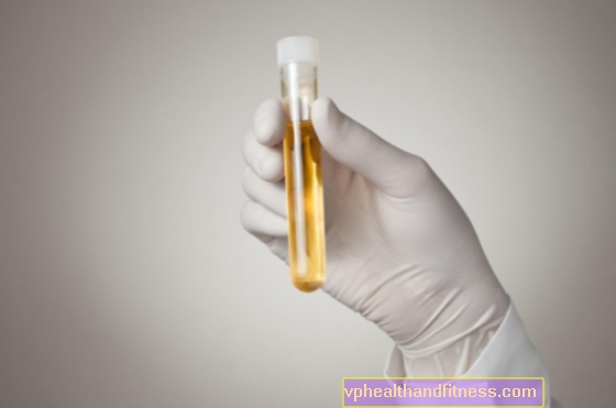 Test antidroga: test per i farmaci nelle urine