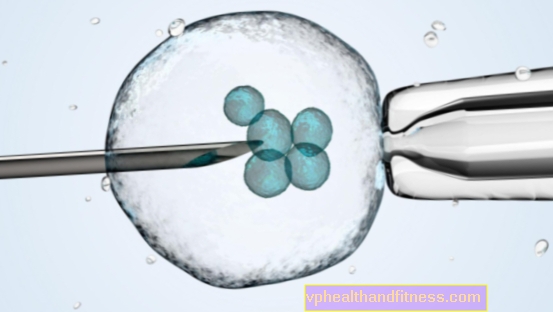 Handle om infertilitetsbehandling med in vitro-metoden - hva garanterer den?