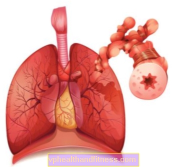 Colonoscopia pleural: examen de los pulmones y la pleura