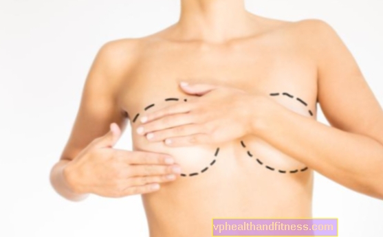 Jak se připravit na operaci prsu? Postup před a po operaci