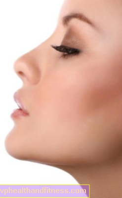 रिनोप्लास्टी। कुटिल और कूबड़ वाली नाक का सुधार कैसा दिखता है?