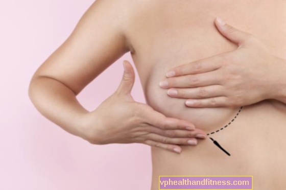 स्तन प्लास्टिक सर्जरी। कमी, भारोत्तोलन और स्तन वृद्धि के उपचार