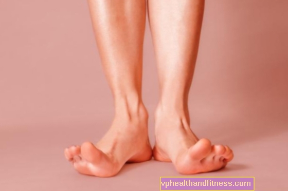 Pėdų šveitimas - išlygina kietą odą. Kaip pasigaminti namų šveitimą?