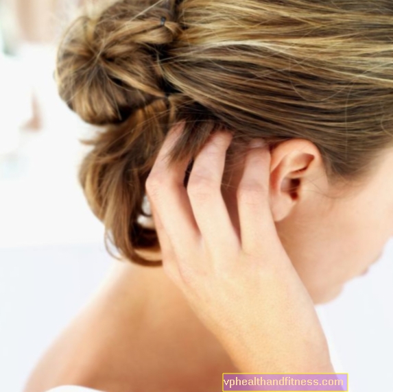 Granos en la cabeza: ¿cómo curar el acné en el cabello?