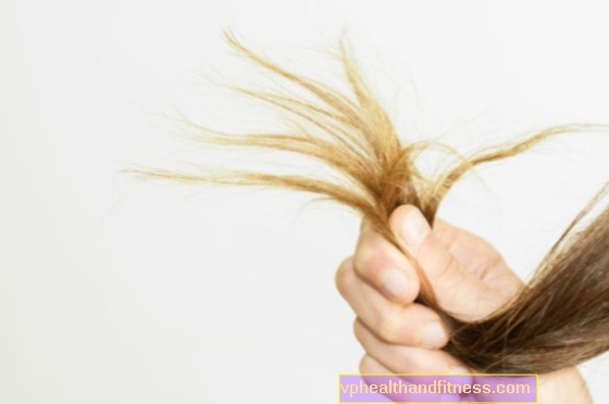 क्षतिग्रस्त और विभाजित बाल समाप्त होते हैं। उन्हें कैसे पुनर्जीवित करें?