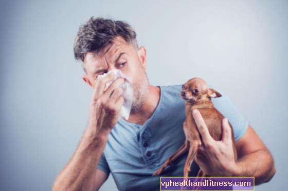 Alergia capilar: síntomas, causas y tratamiento