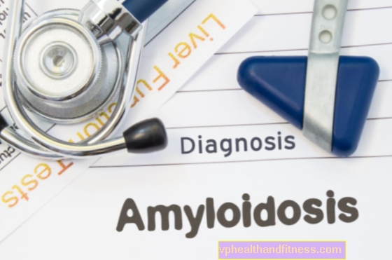 Амилоидоза (амилоидоза): причини, симптоми, лечение