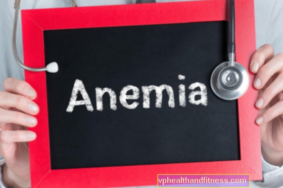 Anemia: síntomas y causas. ¿Cómo tratar la anemia?