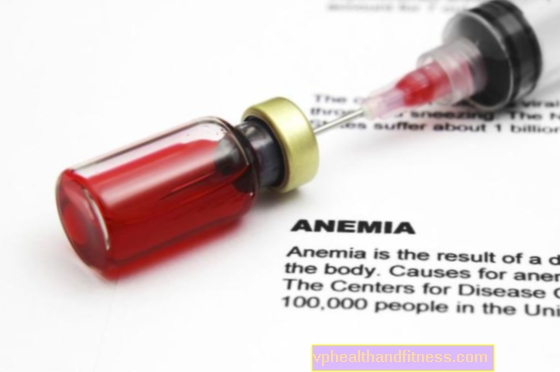 Aplastisk anemi. Typer og symptomer på aplastisk anemi