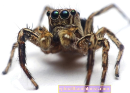 Арахнофобия: причини и симптоми. Как да излекуваме страха от паяци?