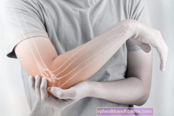 artropatija bol u zglobovima