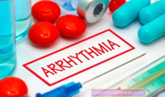 Ventrikulära arytmier: orsaker, typer, behandling