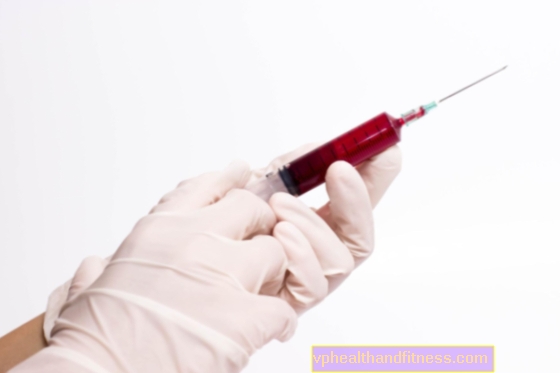 Autohemoterapia: inyección de su propia sangre