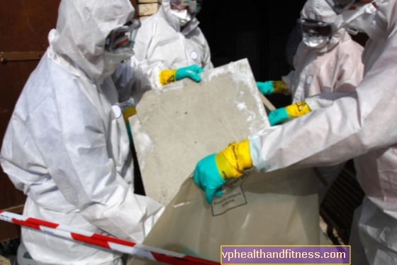 Amianto y asbestosis