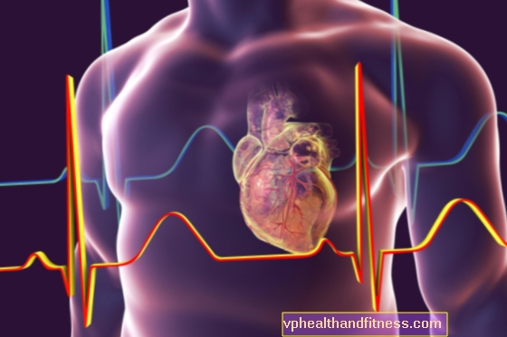 Pengemudi yang aman dengan cardioverter-defibrillator. Bisakah Anda mengemudi dengan ICD?