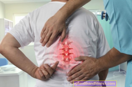 Sāpes mugurā - cēloņi. Ko nozīmē muguras sāpes?