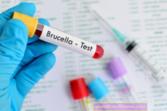 Brucelosis: una enfermedad transmitida por animales