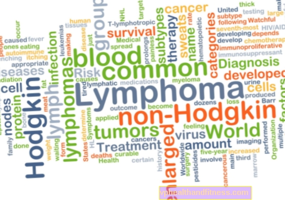 Linfoma: causas, síntomas, tipos, tratamiento