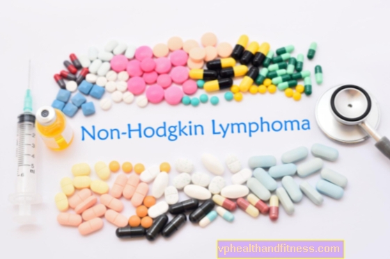 Linfomas no Hodgkin: causas, síntomas, diagnóstico, tratamiento y pronóstico