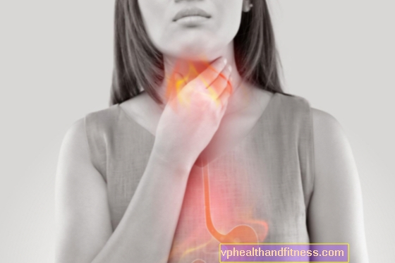 Gastro-oesofageale refluxziekte - oorzaken, symptomen, behandeling
