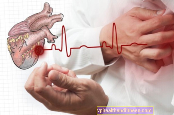 Ischemická choroba srdeční - diagnostika a léčba. Jak léčit ischemickou chorobu srdeční?