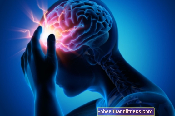 Enfermedades neurológicas: síntomas y tipos.