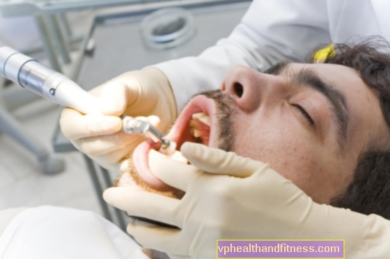Enfermedades periodontales: síntomas, causas, tratamiento.