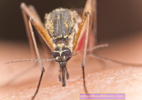 Dirofilariasis: una enfermedad transmitida por mosquitos.